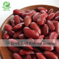 Healthy On Sale British Red Kidney Bean